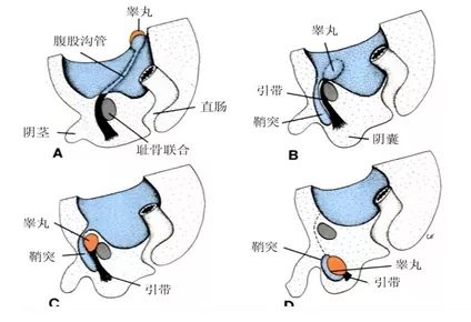 睾丸下坠图片