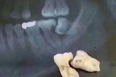 640 (3) 640 (3)