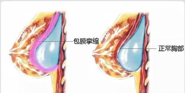 bb4d0aebb311429187452fc4b057e61b_副本 bb4d0aebb311429187452fc4b057e61b_副本