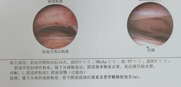 640 (1)_副本 640 (1)_副本