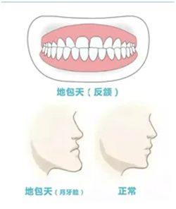 640 (1)_副本 640 (1)_副本