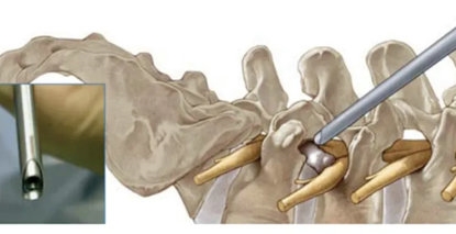 640 (1)_副本_副本 640 (1)_副本_副本