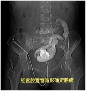 640 (1)_副本 640 (1)_副本