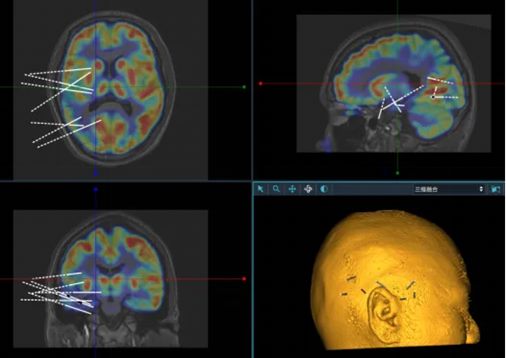 640 (8)_副本 640 (8)_副本