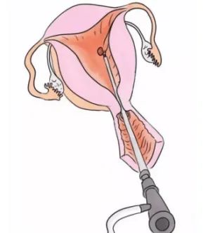 640 (4)_副本 640 (4)_副本