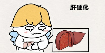 肝硬化也能逆转？中西医联手打造“肝脏修复计划”