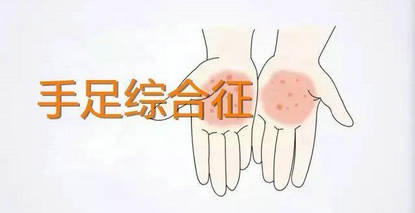 化疗后的她竟坐上了轮椅！被忽视的“手足综合征”有多可怕～