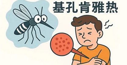 一文读懂这个最需警惕的关节刺客——基孔肯雅热