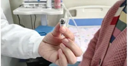 吞颗“胶囊”，手机看胃丨科技让胃部检查如此简单