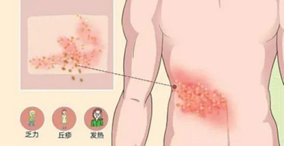 近期高发！警惕是这种病！