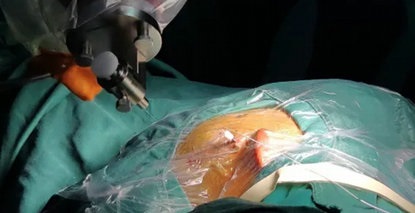 去“痫情”，留“雅致”丨四川“针织小达人”小吉的温暖复诊之旅