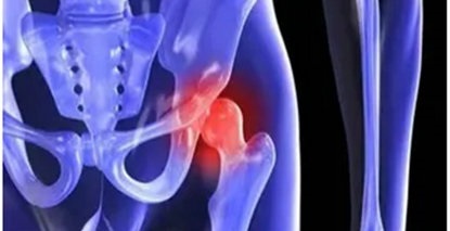 髋部弹响？试试这几个动作！